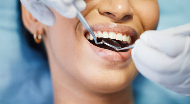 Best Cracked Tooth Emergency Dentist  in Westminster, LA